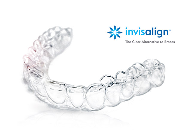 Invisalign